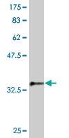 Anti-SKP1 Mouse Monoclonal Antibody [clone: 2E6]