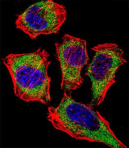 Anti-CA2 Rabbit Polyclonal Antibody