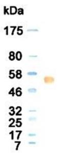 Western blotting result