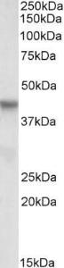 Anti-PINX1 Antibody (A84733) (0.3µg/ml) staining of HepG2 lysate (35µg protein in RIPA buffer). Primary incubation was 1 hour. Detected by chemiluminescence.