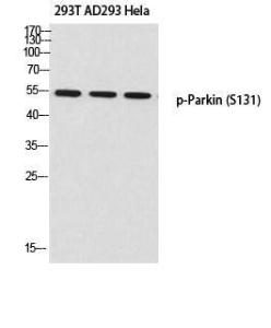 Western blot analysis of 293T AD293 Hela using Anti-Parkin (phospho Ser131) Antibody