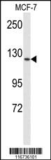 Anti-FLT1 Rabbit Polyclonal Antibody