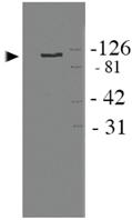 Anti-APBB1 Rabbit Polyclonal Antibody