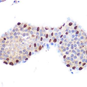 Immunohistochemistry analysis of paraffin-embedded mouse testis using Anti-LXR alpha Antibody [ARC0877] (A307802) at a dilution of 1:100 (40x lens). Perform microwave antigen retrieval with 10 mM PBS buffer pH 7.2 before commencing with IHC staining protocol.