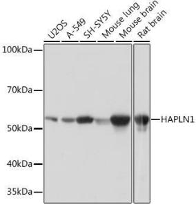 Anti-HAPLN1 Rabbit Monoclonal Antibody [clone: ARC0234]