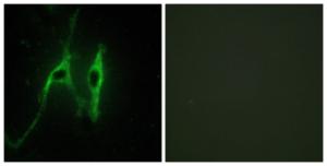 Anti-Cytochrome b5 Rabbit Polyclonal Antibody