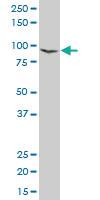 Anti-ACTN1 Mouse Polyclonal Antibody