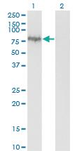 Anti-ENAH Mouse Monoclonal Antibody [clone: 3E6]