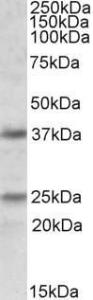 Anti-PDPN Antibody (A83141) (1 µg/ml) staining of Human Cerebellum lysate (35 µg protein in RIPA buffer). Primary incubation was 1 hour. Detected by chemilu minescence