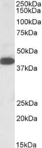 Anti-A4GNT Antibody (A84734) (1µg/ml) staining of K562 lysate (35µg protein in RIPA buffer). Primary incubation was 1 hour. Detected by chemiluminescence.