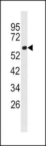 Anti-ACSL3 Rabbit Polyclonal Antibody (PE (Phycoerythrin))