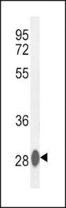 Anti-CA3 Rabbit Polyclonal Antibody