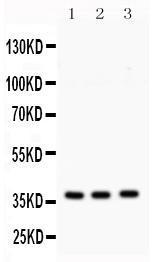 Anti-STX1A Rabbit Polyclonal Antibody