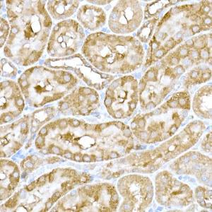 Immunohistochemistry analysis of paraffin-embedded rat kidney using Anti-IRE1 Antibody (A92812) at a dilution of 1:100 (40x lens) Perform high pressure antigen retrieval with 10 mM citrate buffer pH 60 before commencing with IHC staining protocol