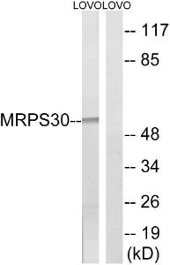 Western blot analysis of lysates from LOVO cells using Anti-MRPS30 Antibody. The right hand lane represents a negative control, where the antibody is blocked by the immunising peptide