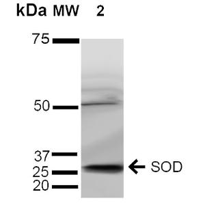 Western blot analysis of human Cervical cancer cell line (HeLa) lysate showing detection of ~35 kDa SOD (EC) protein using Anti-Superoxide Dismutase 3 / EC-SOD Antibody (A304989) at 1:1000 for 2 hours at room temperature