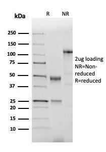 SDS-PAGE analysis of Anti-NKX2.2 Antibody [NX2/2198R] under non-reduced and reduced conditions; showing intact IgG and intact heavy and light chains, respectively. SDS-PAGE analysis confirms the integrity and purity of the antibody.