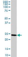 Anti-PYCARD Mouse Polyclonal Antibody