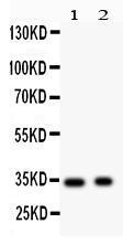 Anti-SYP Rabbit Polyclonal Antibody