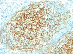 Immunohistochemical analysis of formalin-fixed, paraffin-embedded human tonsil using Anti-VCAM1 Antibody [1.4C3]