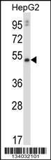 Anti-MMP20 Rabbit Polyclonal Antibody