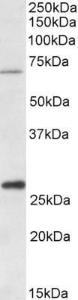 Anti-CPT2 antibody