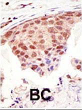 Anti-SUMO1 Rabbit Polyclonal Antibody