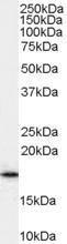 Antibody anti-ARF1 100 µg