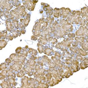 Immunohistochemistry analysis of paraffin-embedded rat pancreas using Anti-IRE1 Antibody (A92812) at a dilution of 1:100 (40x lens) Perform high pressure antigen retrieval with 10 mM citrate buffer pH 60 before commencing with IHC staining protocol