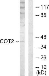 Western blot analysis of lysates from HUVEC cells using Anti-COT2 Antibody The right hand lane represents a negative control, where the antibody is blocked by the immunising peptide