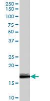 Anti-VHL Goat Polyclonal Antibody