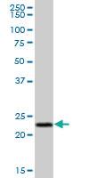 Anti-PYCARD Mouse Polyclonal Antibody