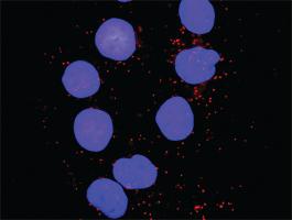 Anti-PXN + MAPK8 Antibody Pair