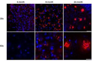 Anti-Amyloid beta-peptide Mouse Monoclonal Antibody [clone: MOAB-2]