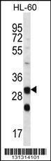 Anti-CA6 Rabbit Polyclonal Antibody (AP (Alkaline Phosphatase))