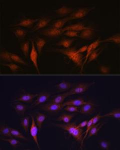 Immunofluorescence analysis of C6 cells using Anti-LXR alpha Antibody [ARC0877] (A307802) at a dilution of 1:100 (40x lens). DAPI was used to stain the cell nuclei (blue).