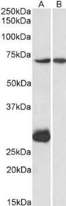 Anti-CPT2 antibody