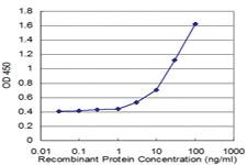 Anti-BNIP1 Mouse Monoclonal Antibody [clone: 1G7]