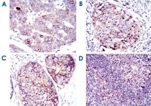 Anti-EEF2 Mouse Monoclonal Antibody [clone: 5B6]