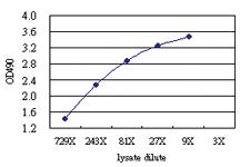 Anti-CD5L Antibody Pair