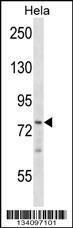 Anti-BRF1 Rabbit Polyclonal Antibody (FITC (Fluorescein Isothiocyanate))