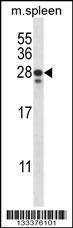 Anti-ANKRD22 Rabbit Polyclonal Antibody (AP (Alkaline Phosphatase))