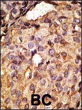 Anti-TLR6 Rabbit Polyclonal Antibody (Biotin)