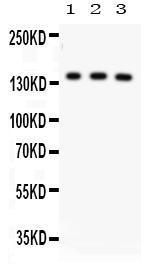 Anti-ABCB11 Rabbit Polyclonal Antibody