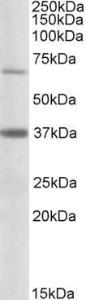 Anti-CPT2 Antibody (A84736) (0.5 µg/ml) staining of Human Liver lysate (35 µg protein in RIPA buffer). Primary incubation was 1 hour. Detected by chemilu minescence