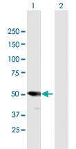 Anti-PSMD5 Mouse Polyclonal Antibody