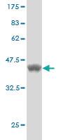 Anti-MTM1 Mouse Monoclonal Antibody [clone: 1C10]