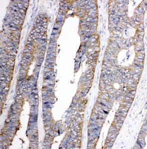 Anti-TRPC3 Rabbit Polyclonal Antibody