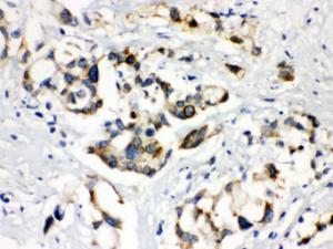 Anti-ABCB11 Rabbit Polyclonal Antibody