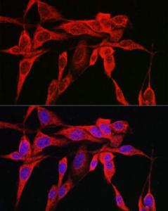 Immunofluorescence analysis of U2OS cells using Anti-IRE1 Antibody (A92812) at a dilution of 1:100 (40x lens) DAPI was used to stain the cell nuclei (blue)